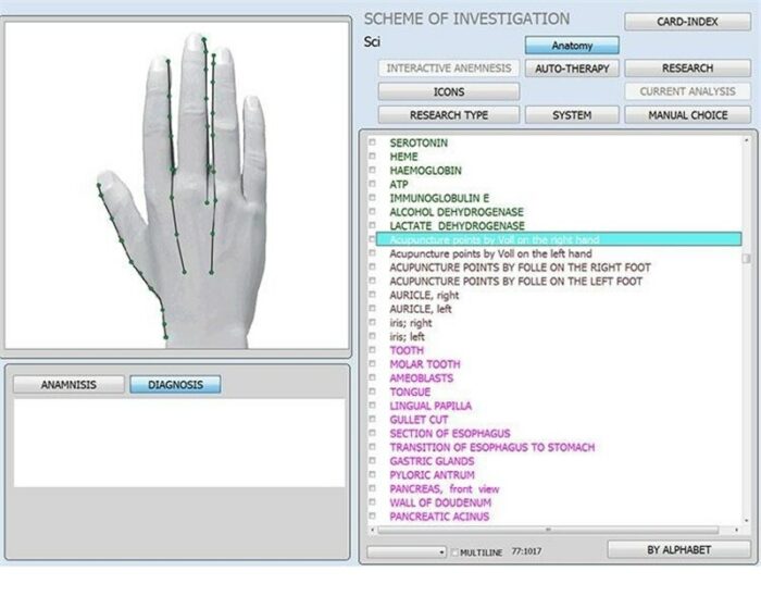 12D NLS CELL NLS AURA CHAKRA IRIS Scanner Sub Body Analyzer NON LINEAR Analyser Bio Analysis Quantum Bioresonance 4